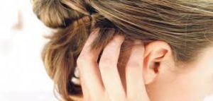 علاج حكة فروة الراس وتساقط الشعر