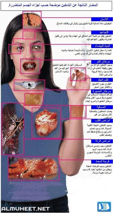 اضرار التدخين بالصور وسلبياته على الانسان 11