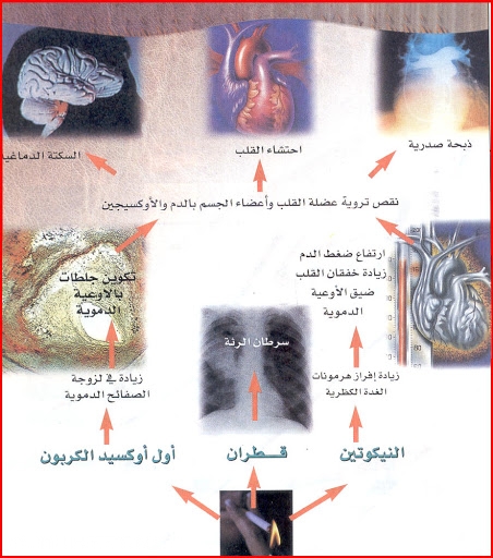 اضرار التدخين بالصور وسلبياته على الانسان 13