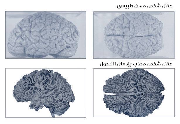 تأثير المخدرات على الجسم 2