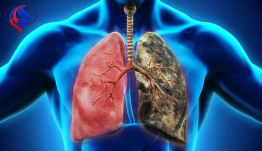 اضرار التدخين بالصور وسلبياته على الانسان 9