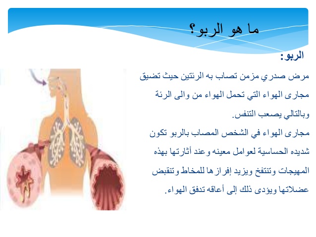 بحث عن مرض الربو ppt 1