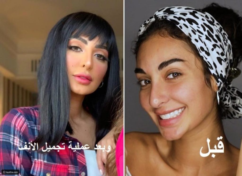 نور الغندور قبل وبعد 4