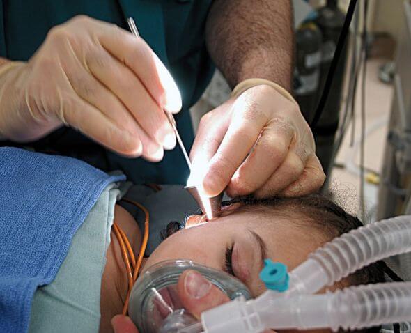 تجربتي مع ثقب طبلة الاذن- علاج ثقب طبلة الأذن بالليزر