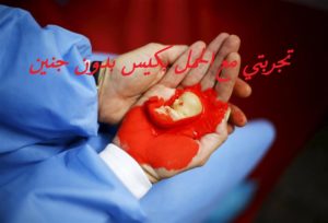 تجربتي مع الحمل بكيس بدون جنين
