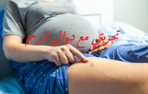 تجربتي مع دوالي الرحم