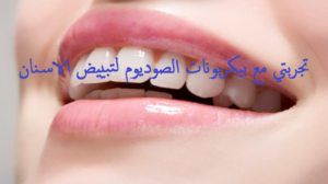 تجربتي مع بيكربونات الصوديوم لتبييض الاسنان