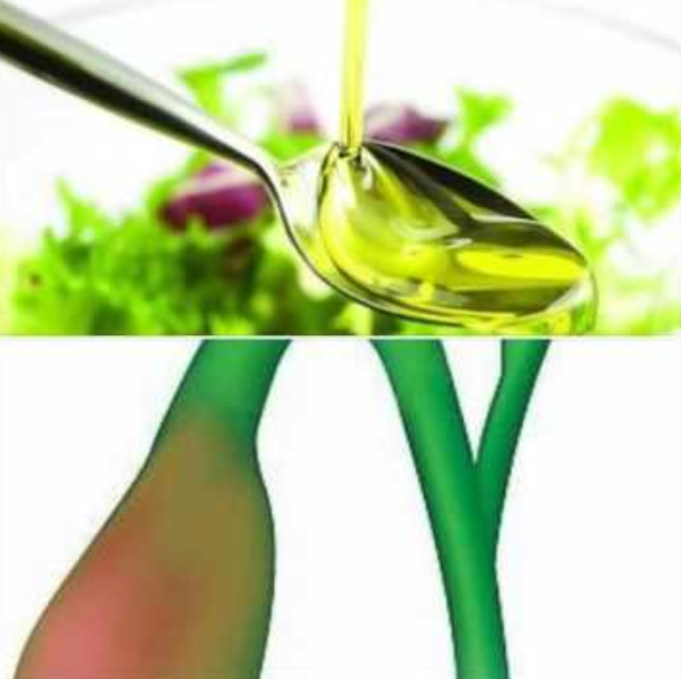 علاج حصى المرارة زيت الزيتون