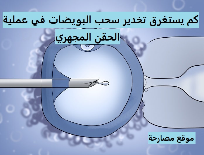 كم يستغرق تخدير سحب البويضات