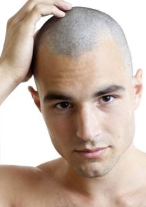 تجربتي في حلق شعري