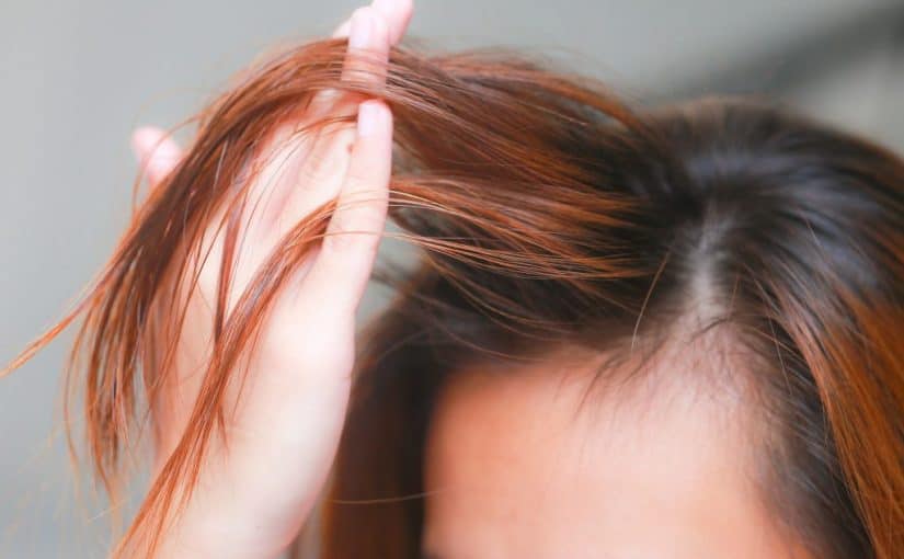 علاج تساقط الشعر للنساء مجرب