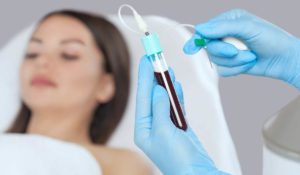 مين جربت حقن البلازما للمبيض