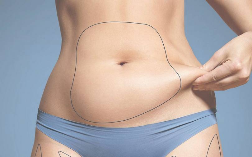 متى تظهر نتائج تجميد الدهون