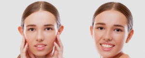 تجربتي مع عملية تجميل الاذن