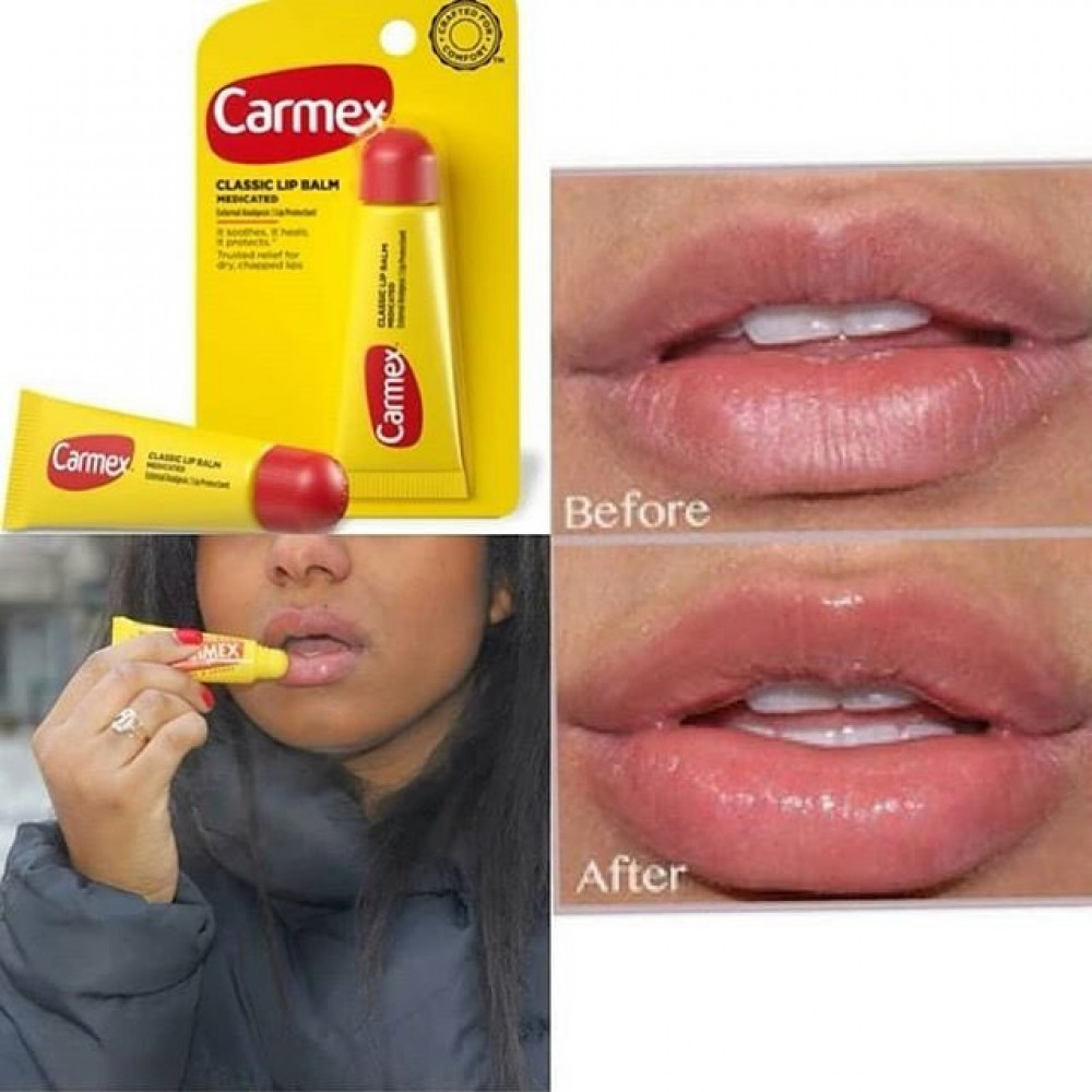 مرطب Carmex يذوب الفيلر
