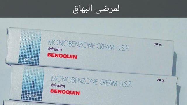 مدى فعالية كريم بنكوين للبهاق