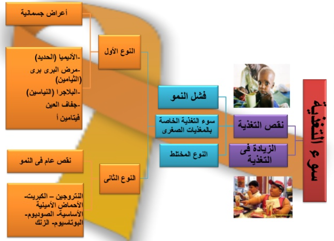مطويات عن سوء التغذية 5