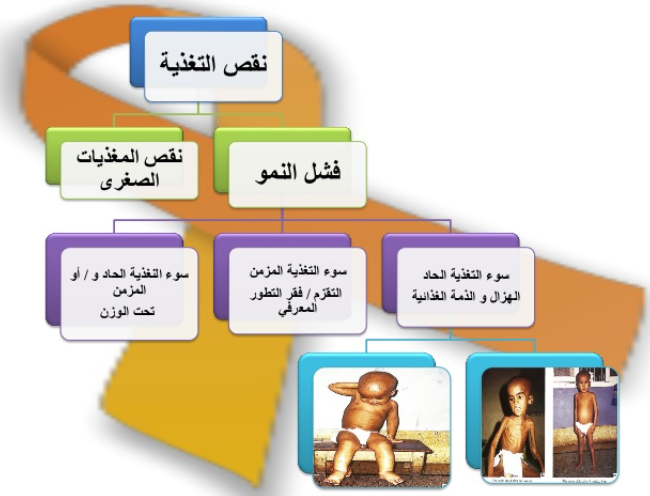 مطويات عن سوء التغذية 6