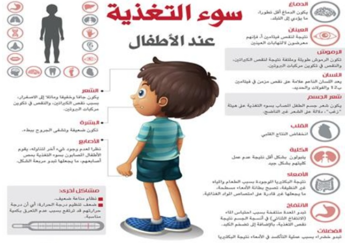 مطويات عن سوء التغذية 7