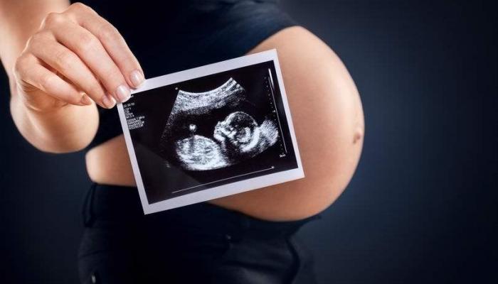 مين كان عندها الجنين في اليسار وجابت ولد