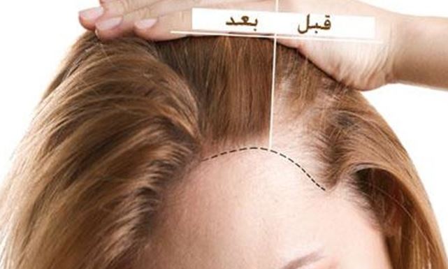 افضل امبولات الخلايا الجذعية للشعر
