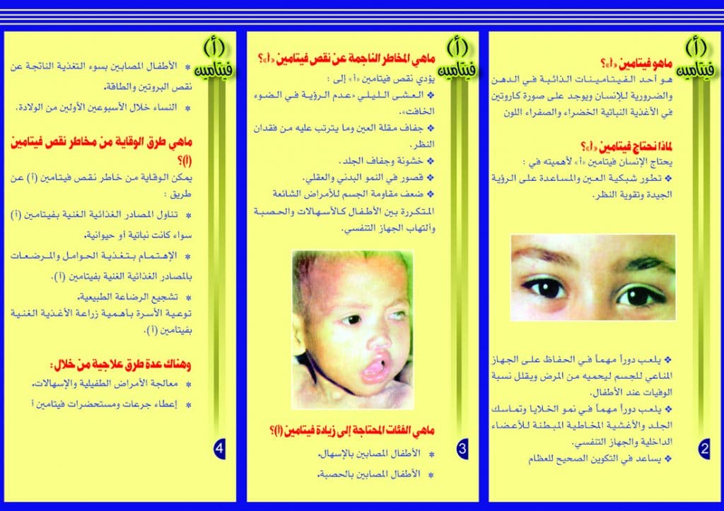 مطـويات عن صحة العين 4