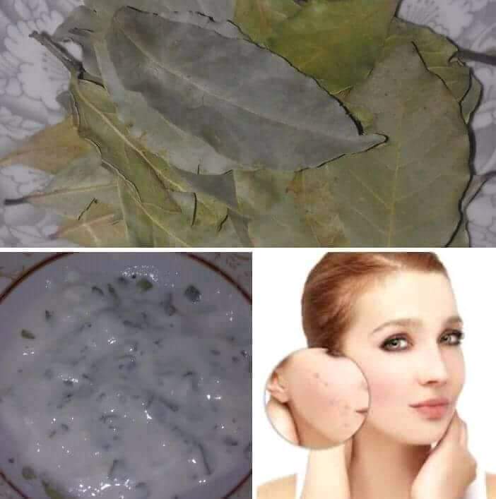 تجربتي مع ورق الغار للوجه