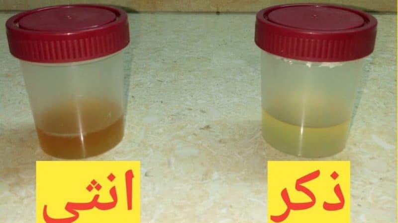 مين جربت طريقة الكلور لمعرفة الحمل ٣