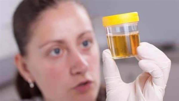 أفضل مضاد حيوي لعلاج صديد البول
