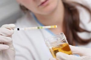 أفضل مضاد حيوي لعلاج صديد البول
