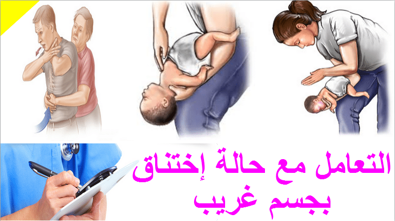 الإسعافات الأولية بالصور 2