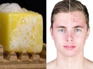 متى تظهر نتائج صابونة الكبريت