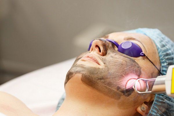 متى تظهر نتائج ليزر الفراكشنال