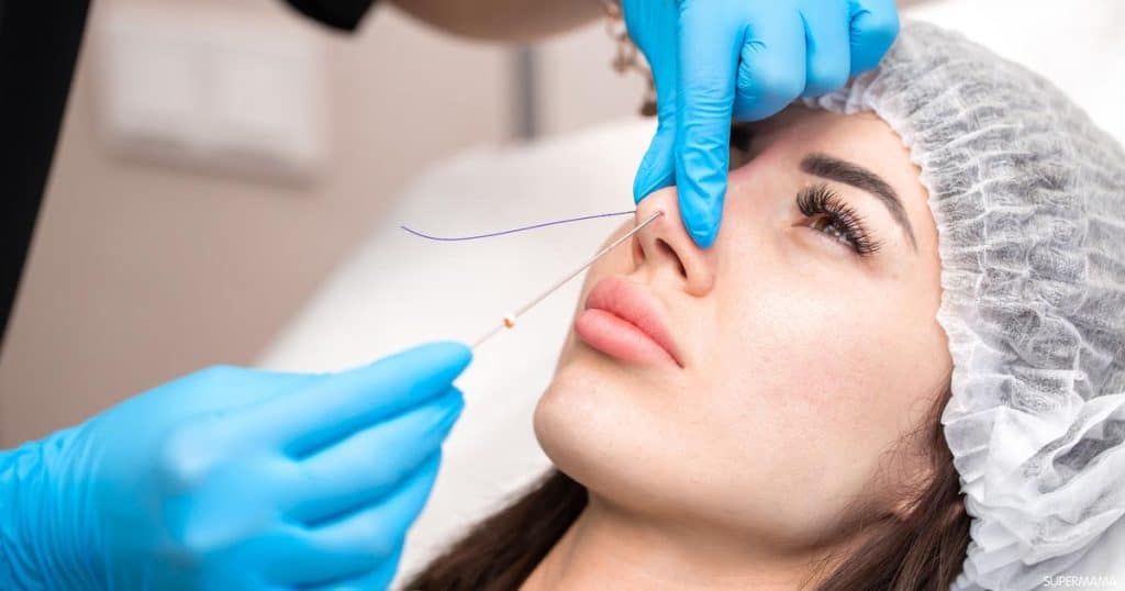 تجميل الأنف بالخيوط