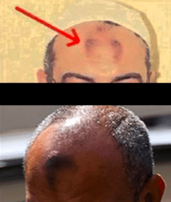 أسباب ظهور علامة الصلاة