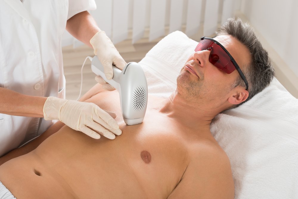 إزالة شعر الوجه بالليزر للرجال