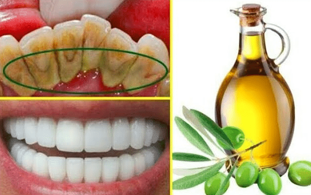 إزالة جير الأسنان بزيت الزيتون