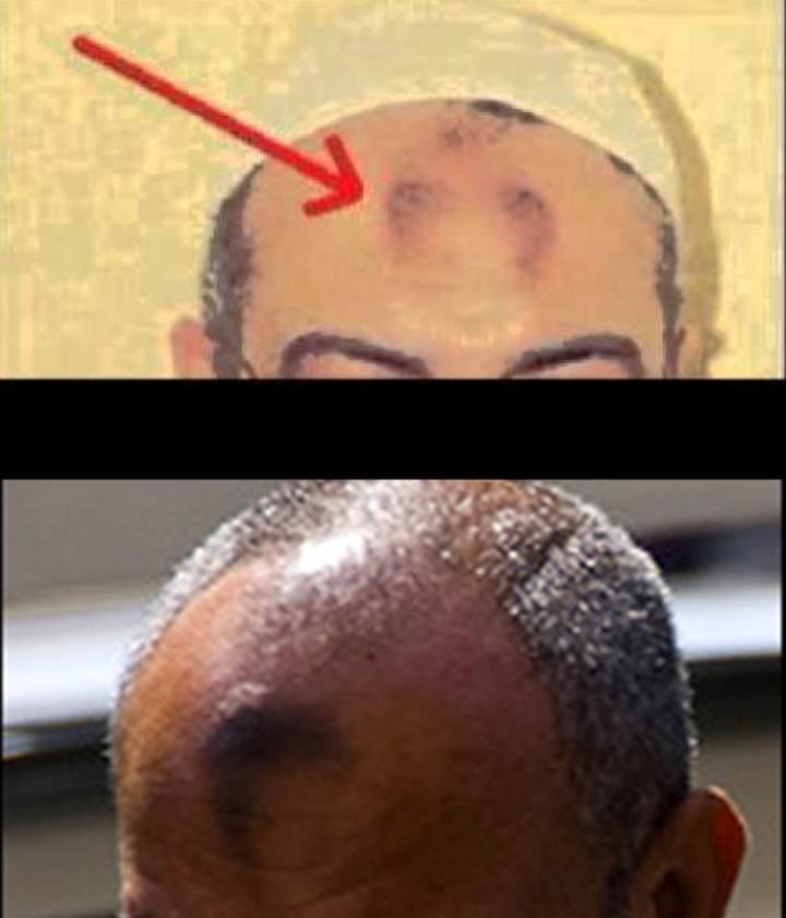 ازالة علامة الصلاة على الجبهة