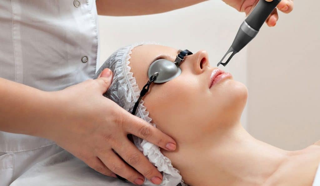 إزالة شعر الوجه بالليزر