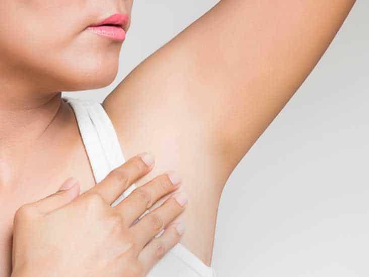 علاج كلف الحمل في المناطق الحساسة