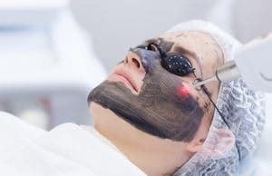 رايكم في الليزر الكربوني