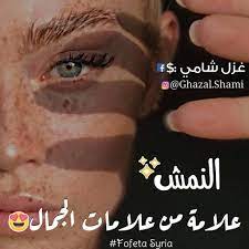 هل النمش من علامات الجمال