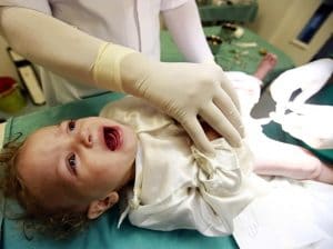 افضل دكتور ختان في جازان