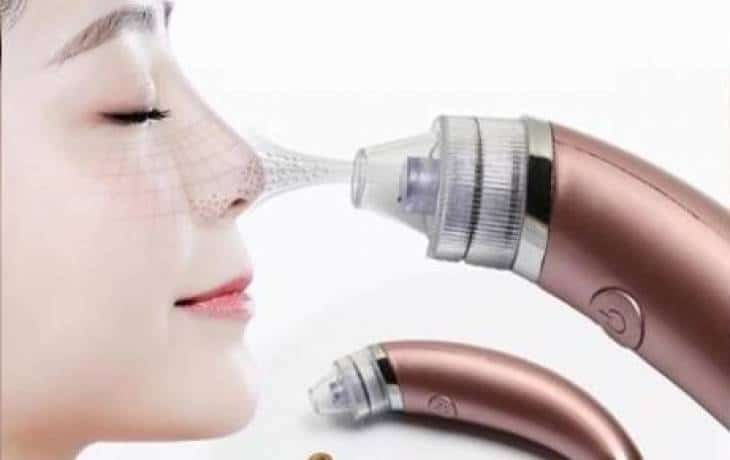 تجربتي مع جهاز شفط الرؤوس السوداء