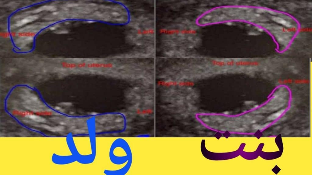 شكل كيس الحمل البيضاوي بالصور2