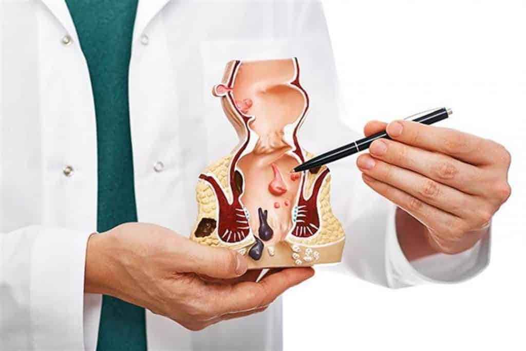 الفرق بين البواسير الخارجية والداخلية