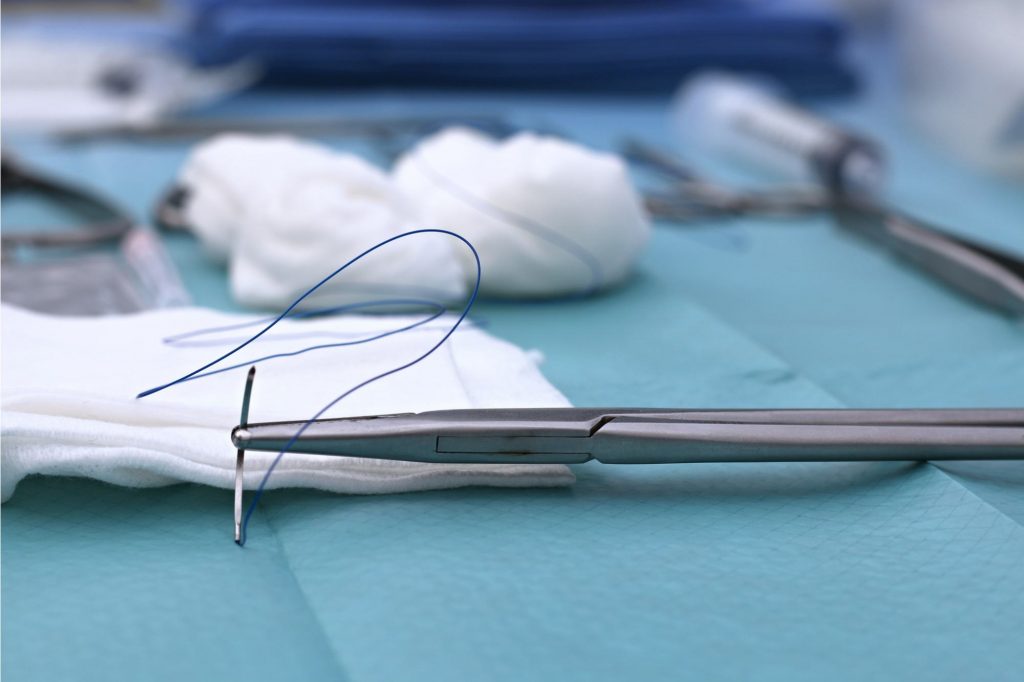 طريقة الخياطة التجميلية بعد الولادة