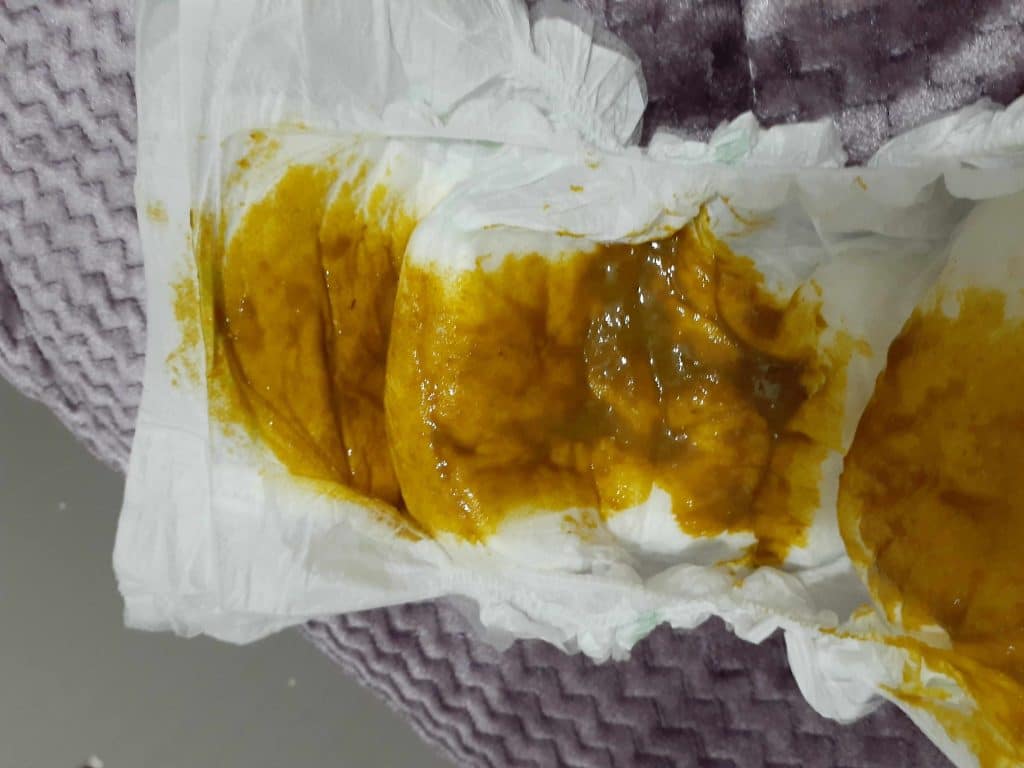 براز الرضيع أخضر واصفر ورائحته كريهة
