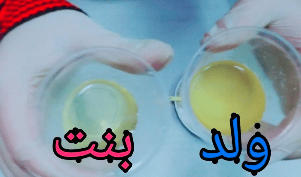 لون بول الحامل ببنت