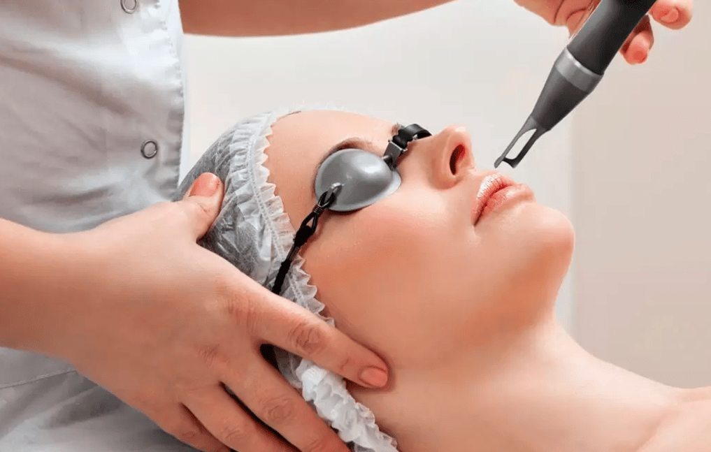 ليزر شنب الوجه 